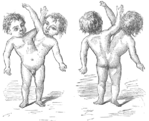 Ildefonso José y José Ildefonso